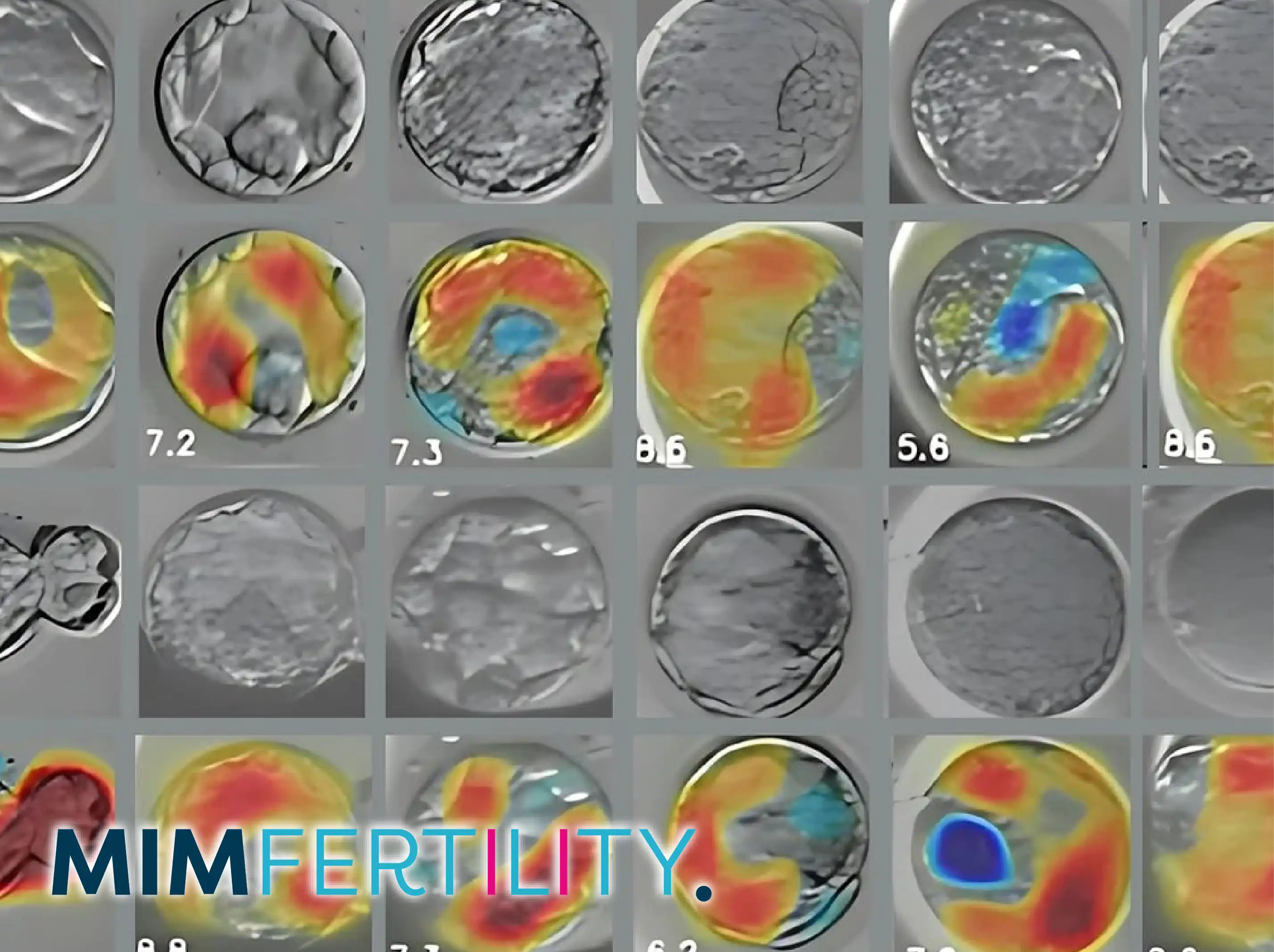 MIM Fertility EMBRYOAID